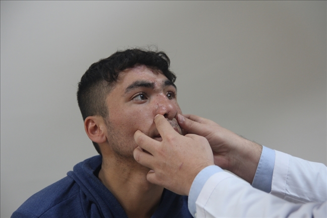 Dağılan yüzü, vücudundan alınan parçalarla birleştirildi