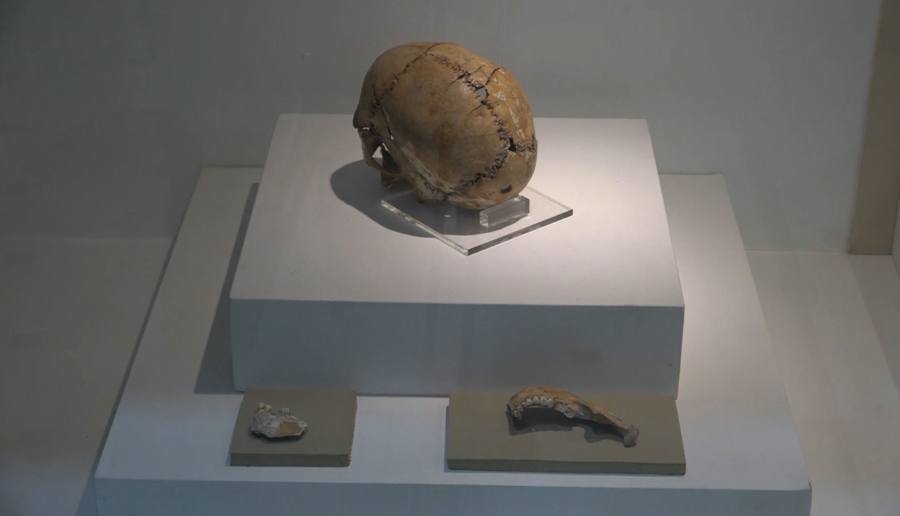 Dünyadaki ilk beyin ameliyatının yapıldığı Aşıklı Höyük  tarihe ışık tutuyor
