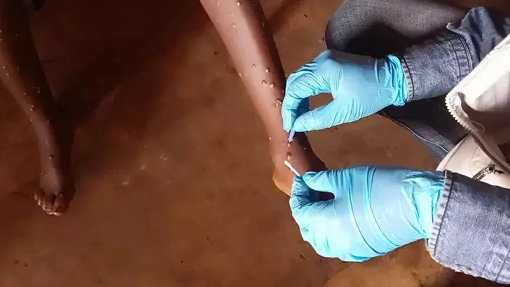 Uganda