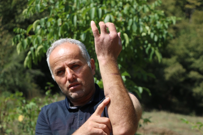 Babası gibi ayı saldırısına uğradı; parmağı koptu