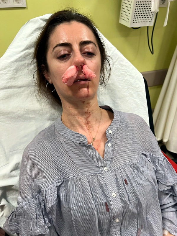 Eşinin sevgilisi sandığı kadını darbettiği 